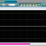 Electromyography display screen.